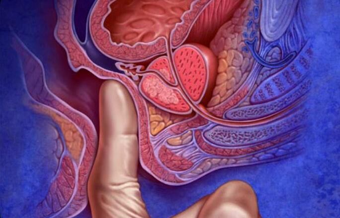 Masaža prostate